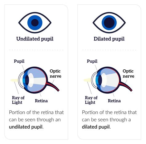 what is dilating your eyes